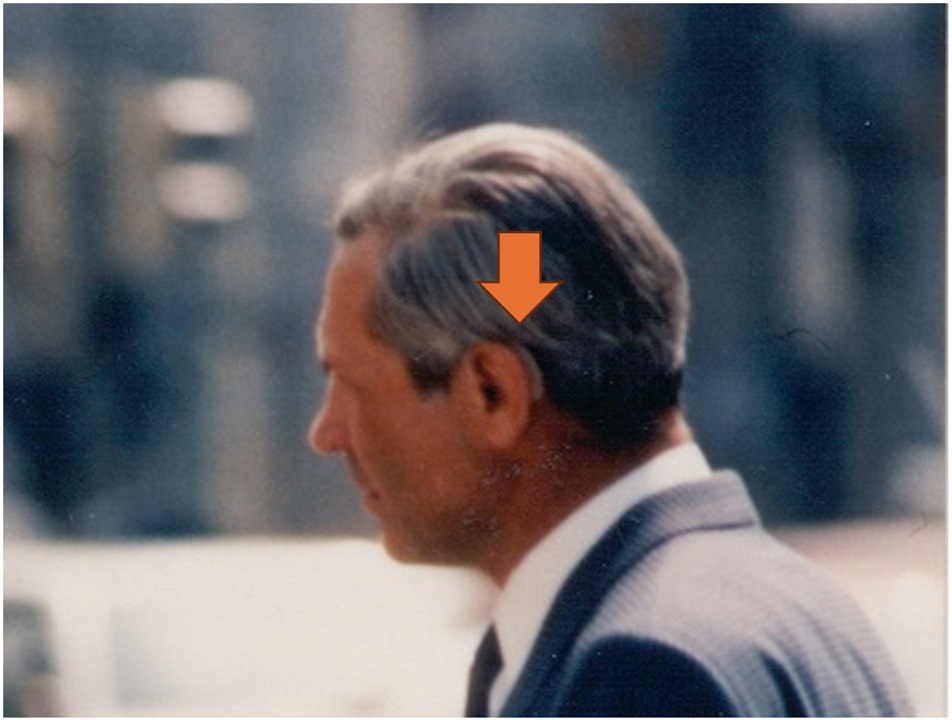 1980年代の写真、男性が補聴器を装用している状態