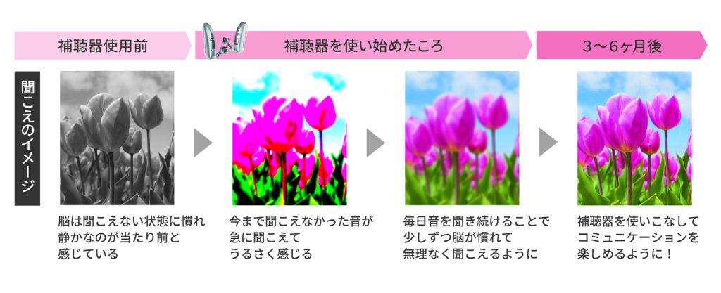 補聴器を使い始めてもすぐにきれいに聞こえるようにはならず、少しずつ慣らしていく必要がある。