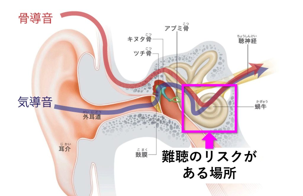 気導音も骨導音も蝸牛に集まるので、骨伝導でも難聴のリスクは同様。
