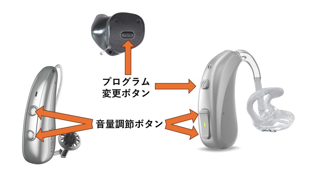 補聴器本体には、音量調節ボタンやプログラム変更ボタンがついているものがあります